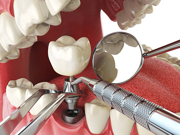 Best Emergency Denture Repair in Brightwaters, NY